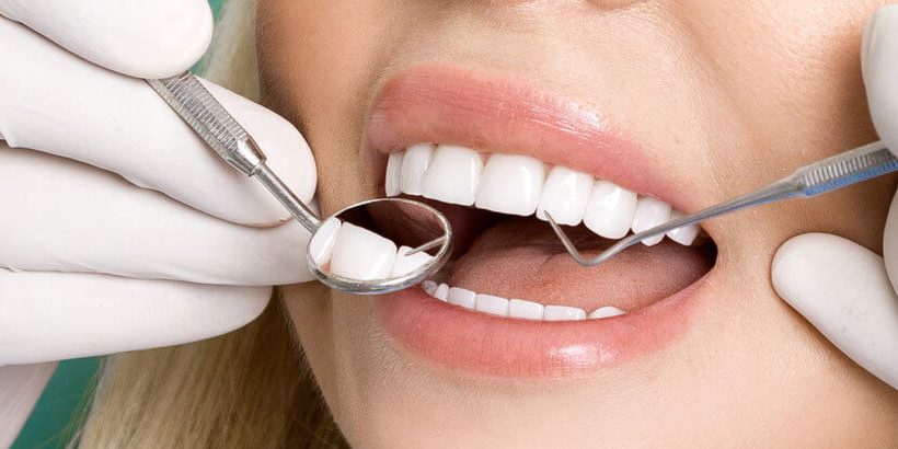 Gülüş Tasarımında Hangi Materyaller Seçilir?